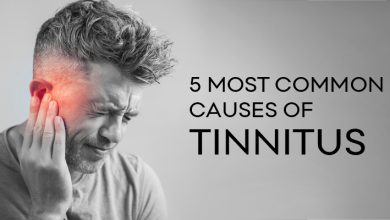 Photo of 5 MOST COMMON CAUSES OF TINNITUS