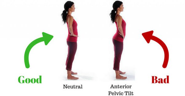 5 Exercise to fix the anterior pelvic tilt