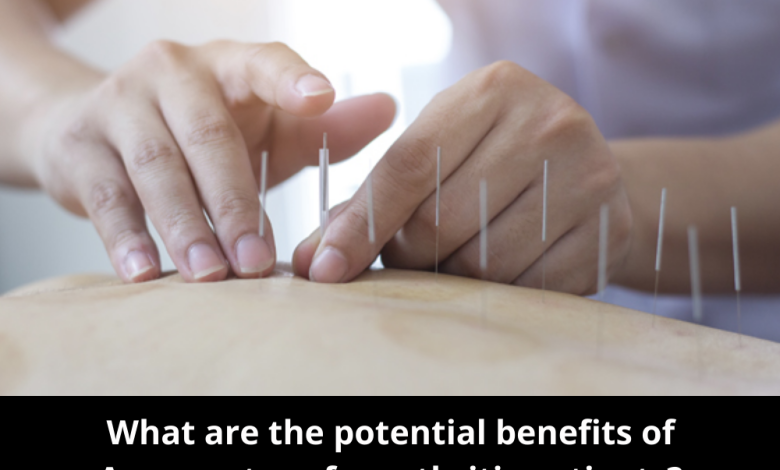 What are the potential benefits of Acupuncture for arthritis patients